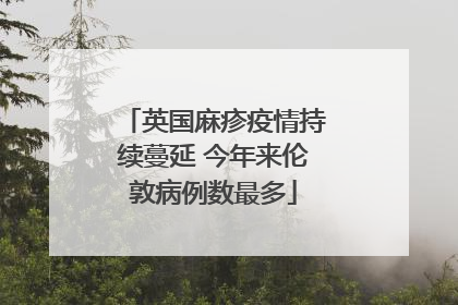 英国麻疹疫情持续蔓延 今年来伦敦病例数最多
